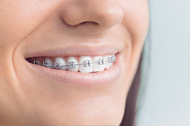 Best Orthodontics  in Tequesta, FL